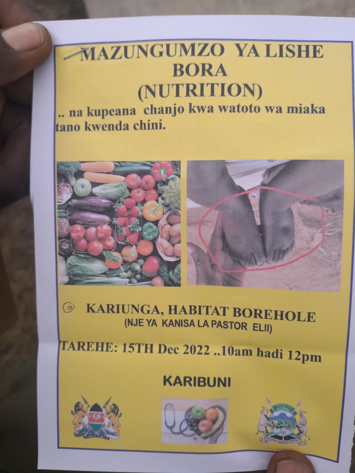 Malnutrition poster